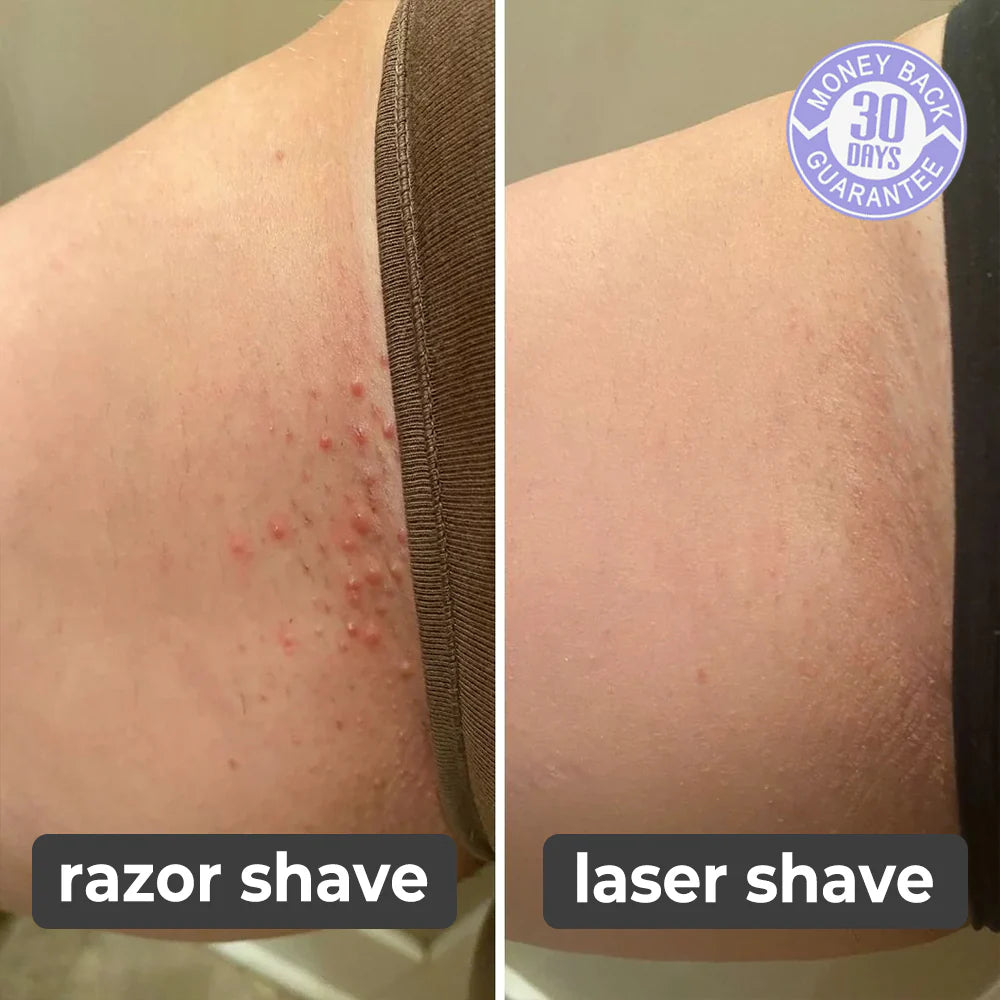 Silk Smooth Painless & Cuts Free Hair Remover !